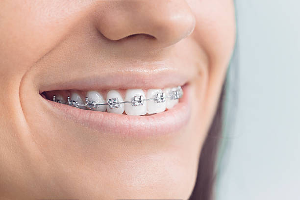 Full Mouth Reconstruction in Bogota, NJ